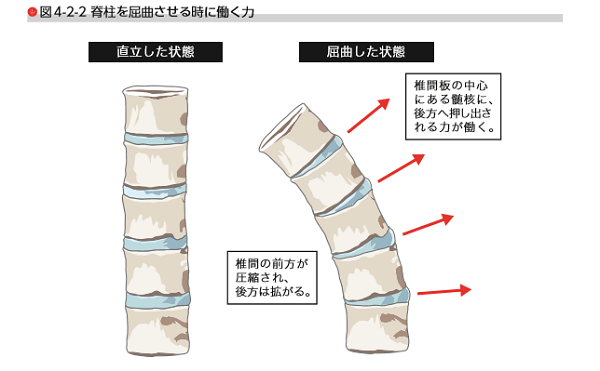 しゃがみ込み 腰痛 腸腰筋癒着