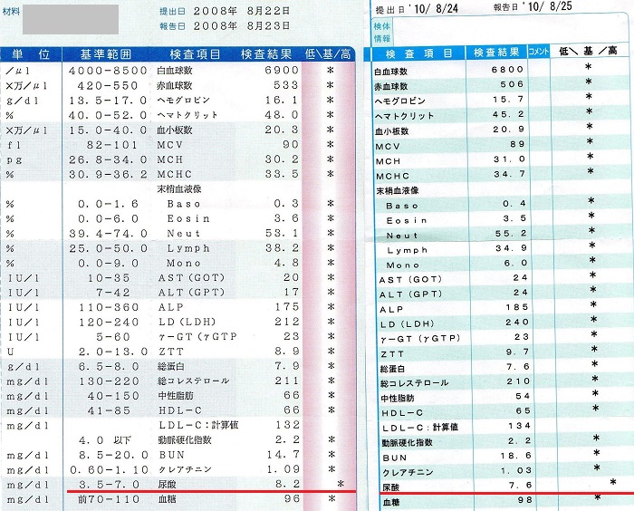 筋トレすると痛風になる