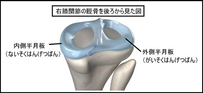 ランニング 膝の痛み 解消法