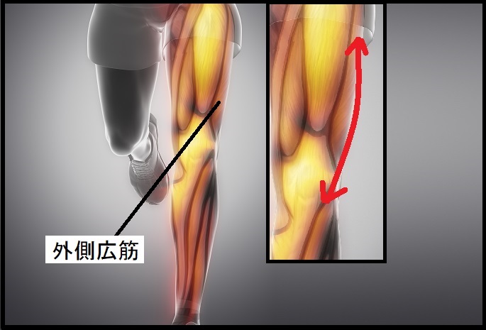 ランニング 外側広筋