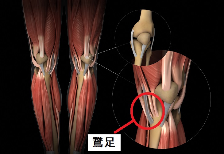 ランニング 膝の痛み 解消法