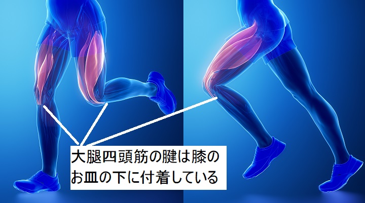 遠心性収縮　大腿四頭筋