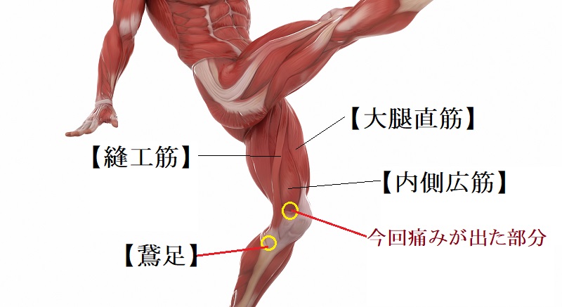 膝の痛み　対処法　