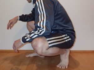 腸腰筋の拘縮 痙攣 腰痛