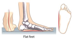 足首強化法 ブログ