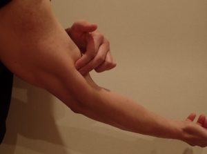 肘内側 痛み 腕橈骨筋・上腕筋 ブログ