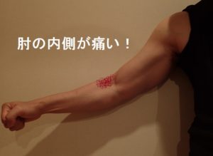 肘内側 痛み 上腕筋 ブログ