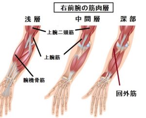 回外筋 痛み 原因