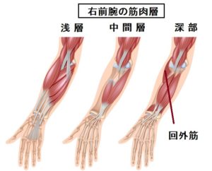 回外筋 痛み 原因 解消法