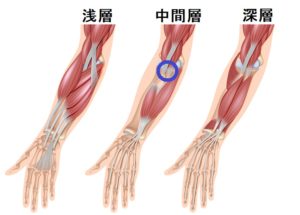 肘の痛み、肘窩 痛み 解消法 改善法