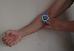 肘窩 痛み 原因 ブログ