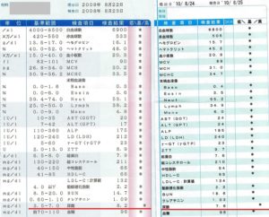 筋トレすると痛風になる
