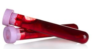 タンパク質　プロテイン　腎機能　血液検査