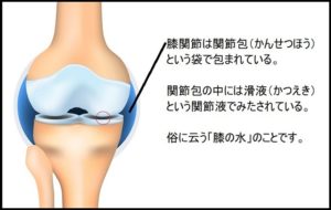ランニング 膝の痛み 解消法