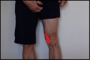 ランニング 内側広筋