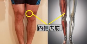 内側広筋 ランニング 膝痛