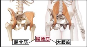 反り腰　でっちり　ストレッチ