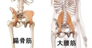 腸腰筋が固いと腰痛になりやすい