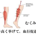 足のむくみ・浮腫を予防・解消する方法