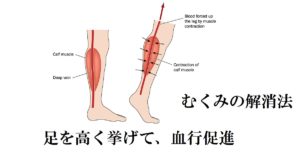 足のむくみ・浮腫を予防・解消する方法