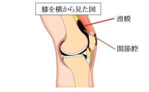 膝の水　原因