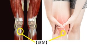 膝の痛み　対処法　