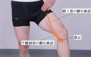 鵞足炎　治療法　対処法　膝内側の痛み