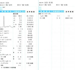 顎下 リンパ腺 脹れ 疲労